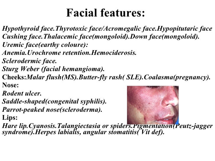 Get chubby on 43things Facial rash hypothyroidism